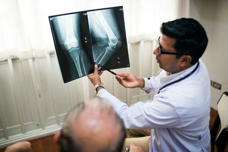 Knee Replacement Recovery: Rehab in Johannesburg